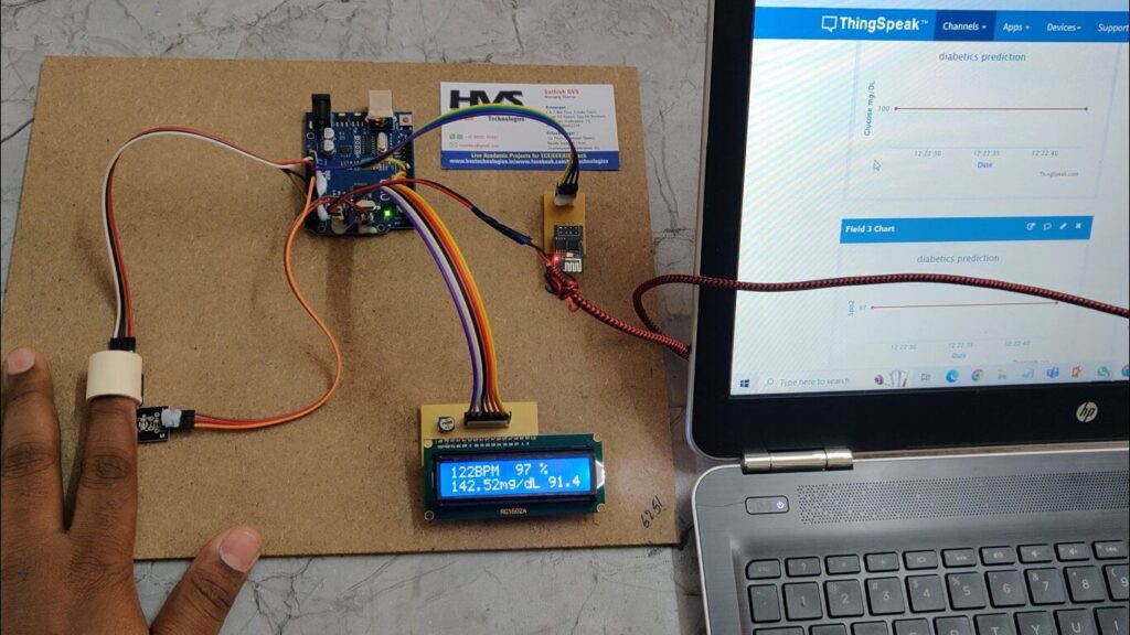 HVS-4210 Noninvasive Diabetics prediction
