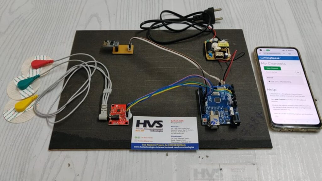 HVS-4746. ECG monitoring and Alerting system Using IoT.
