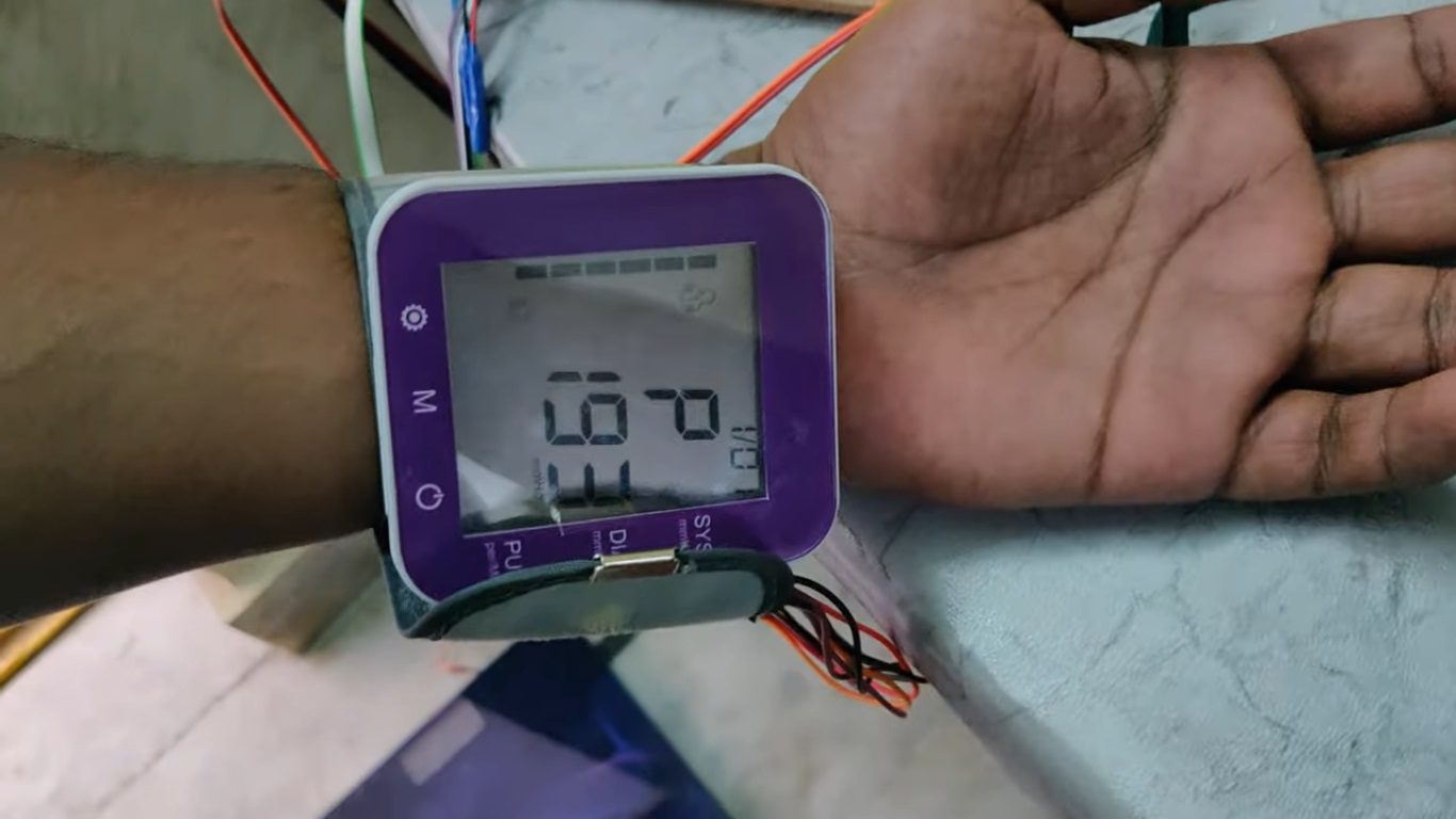 HVS-4795. Vital sign monitoring for OPD patients Height, Weight,BP, Glucometer, Heart rate, SPO2, Temperature