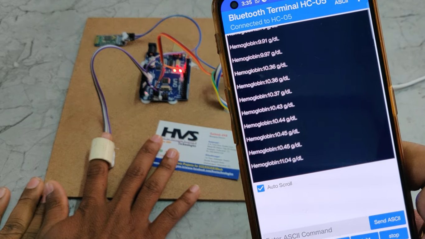 HVS-4777. Noninvasive Hemoglobin Sensing using ML Raspberry pi and Bluetooth.