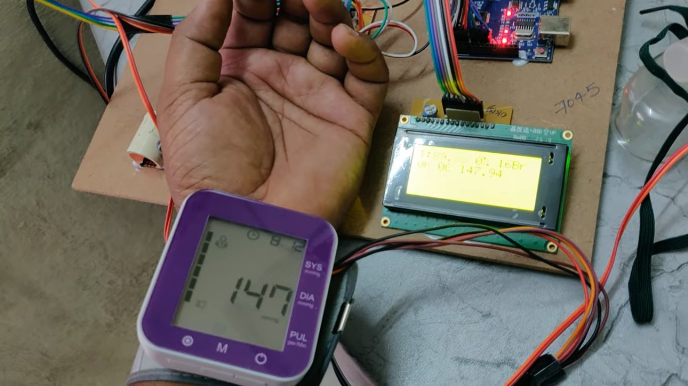 HVS-4795. Vital sign monitoring for OPD patients Height, Weight,BP, Glucometer, Heart rate, SPO2, Temperature