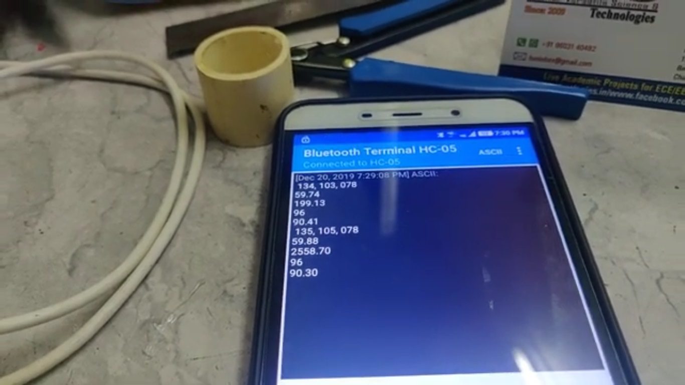 HVS-4740. Health Kiosk - BMI, Heart rate, SPO2, BP, Height, weight through Bluetooth.