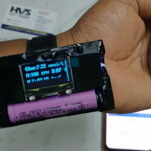 HVS-5016. IoT Non-invasive Glucometer with Heart Rate, SPO2 and Temperature to Thingspeak Storing.