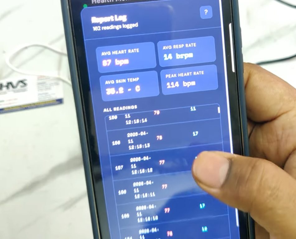 HVS-5039. Non-Invasive Cardiopulmonary Sensing with Cloud Analytics via Sensor Fusion Data Stream