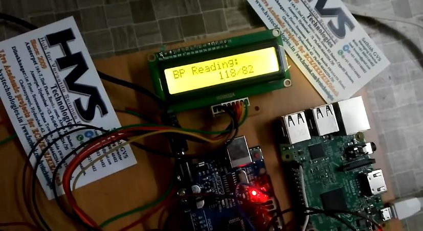 HVS-2312. Management of diabetes in children based on IOT - Raspberry Pi and Embedded LINUX